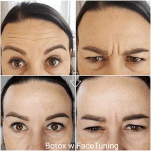 Facetuning