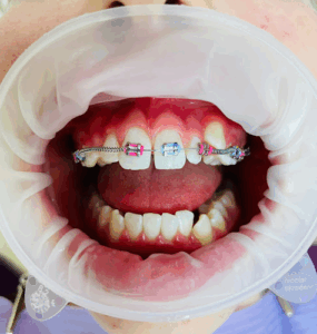 Prodentist