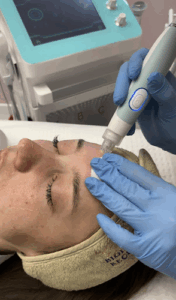 Skinbar.kp